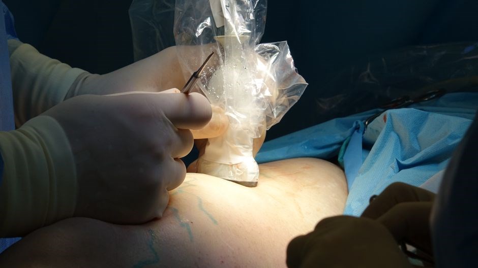 pleurx catheter drainage instructions